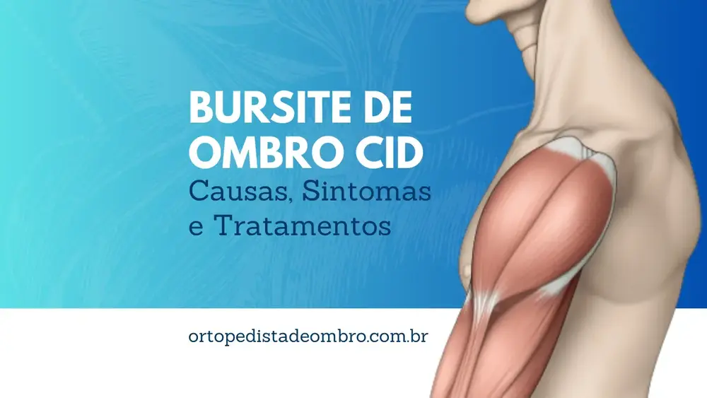 Bursite de Ombro CID Causas, Sintomas e Tratamento
