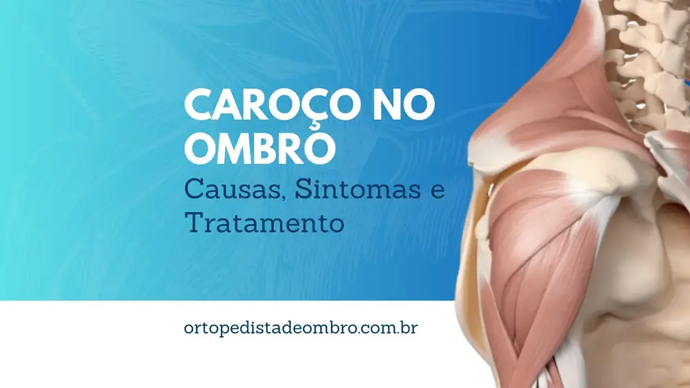 Caroço no Ombro Causas, Sintomas e Tratamento