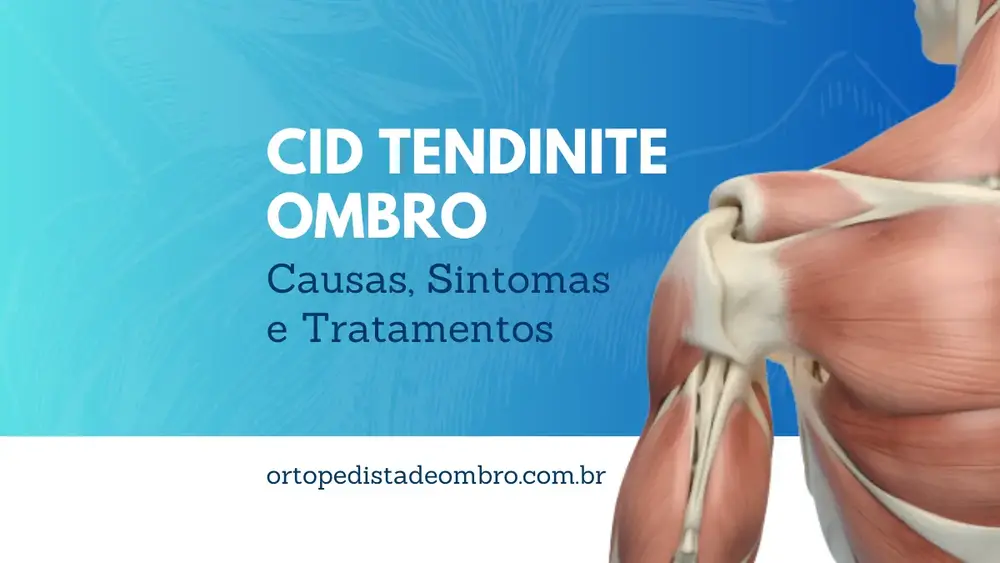 CID Tendinite Ombro Causas, Sintomas e Tratamentos