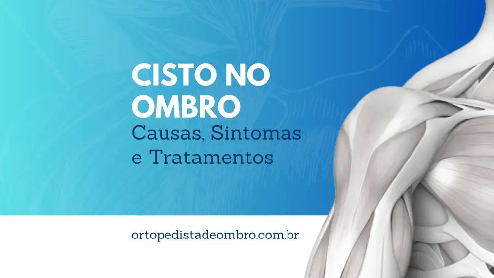 Cisto no Ombro Causas, Sintomas e Tratamentos